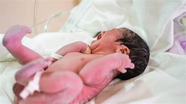 What is a mermaid baby?