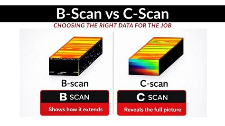What is a OTC scan?