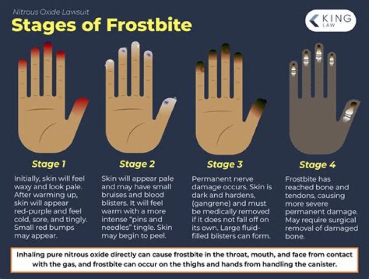 What is frostbite worth in mm2?