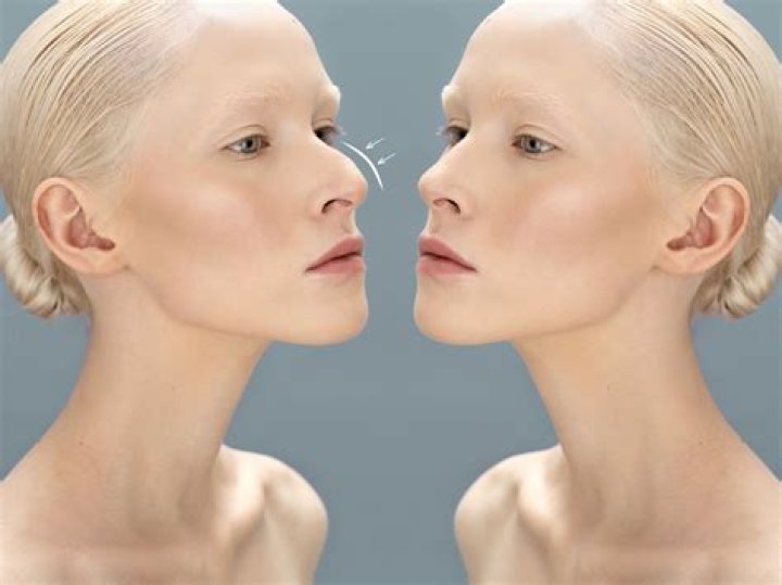 What is the best age to get a nose job for a girl?