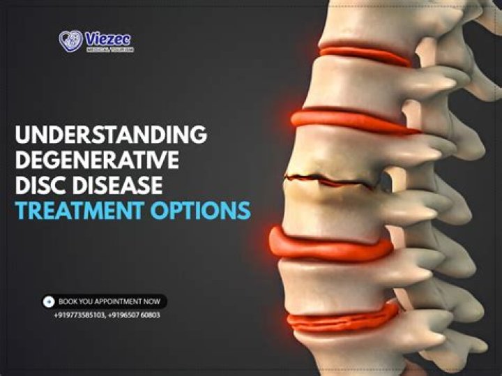 What is the best treatment for degenerative disc disease?