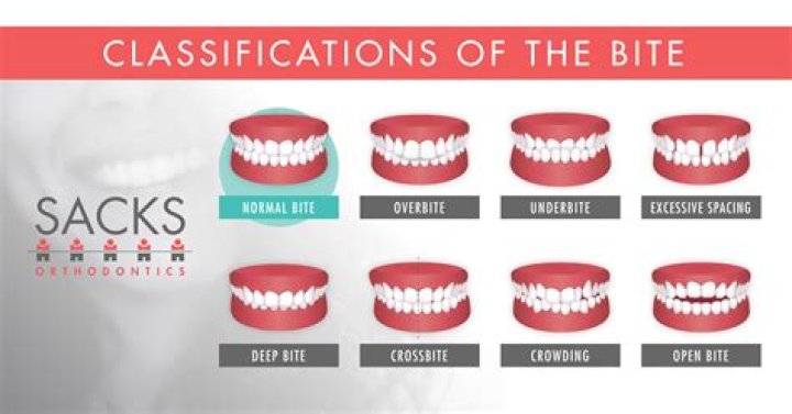 What is the correct bite for dentures?