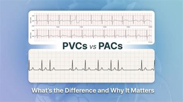 What is the difference between a PAC code and a PUK code?