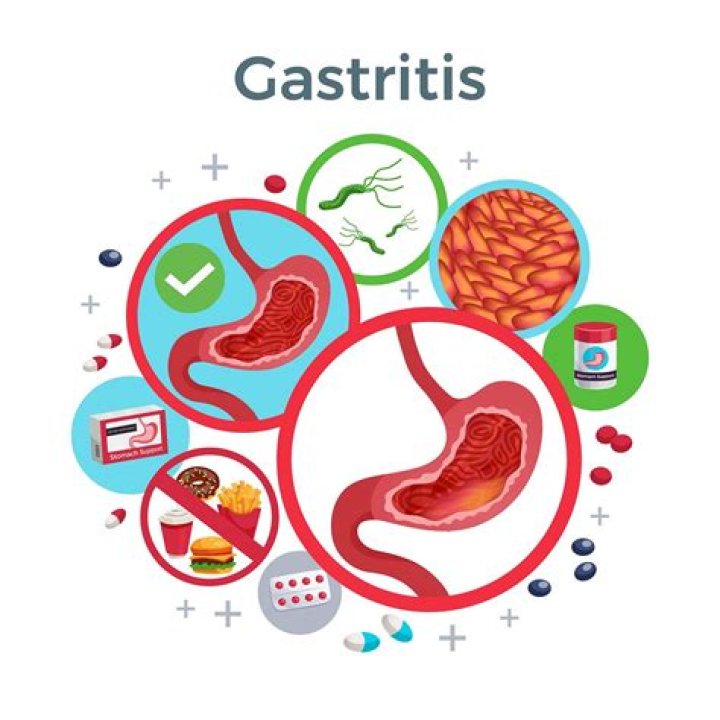 What is the fastest way to cure gastroenteritis?