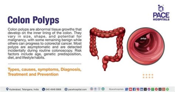 What is the largest colon polyp found?