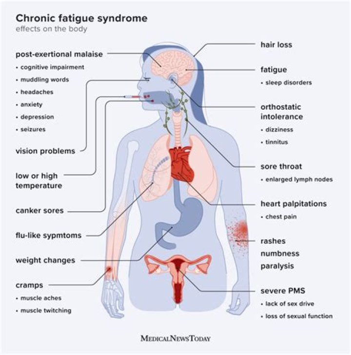 What is the life expectancy of someone with chronic fatigue syndrome?