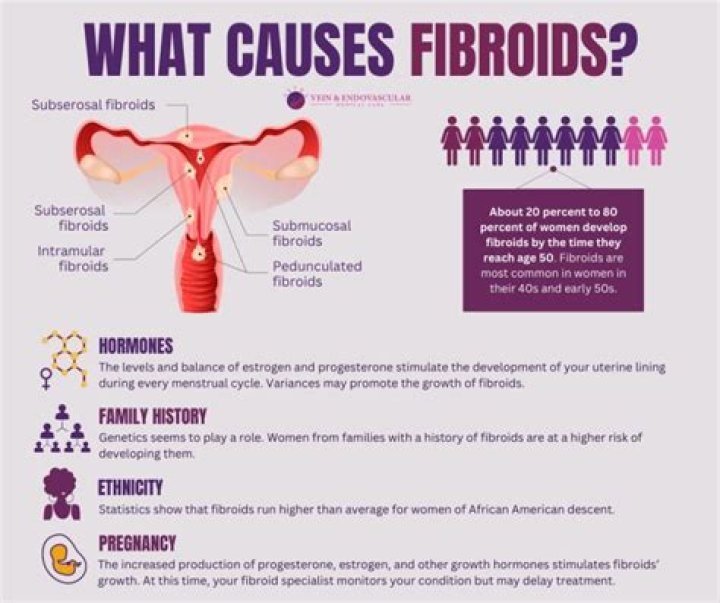 What is the main cause of fibroids?