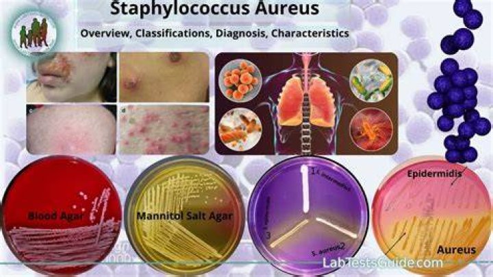 What is the main cause of Staphylococcus aureus?