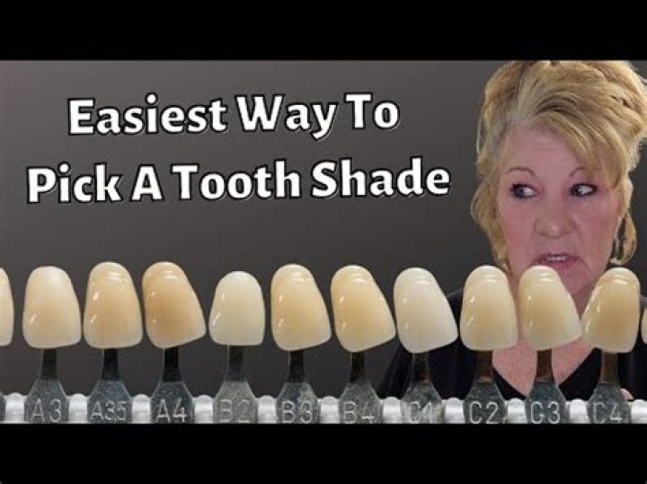 What is the whitest shade of dentures?