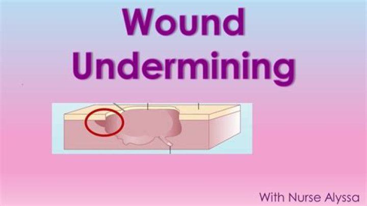 What is undermining in a relationship?