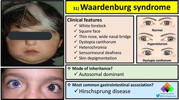 What is white forelock?