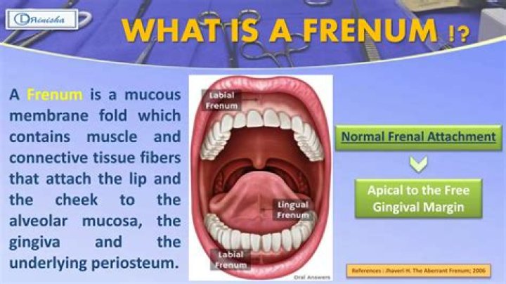What is your frenum?
