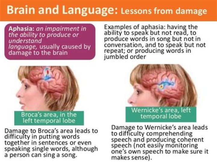 What kind of stroke affects speech?