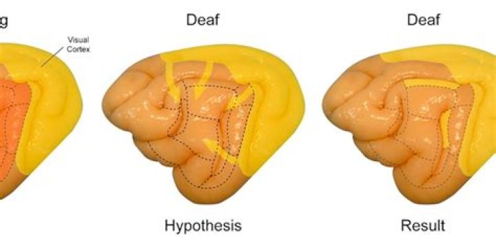 What language do deaf people think in?