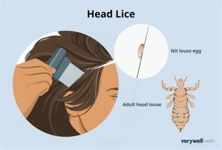 What oil do lice hate?