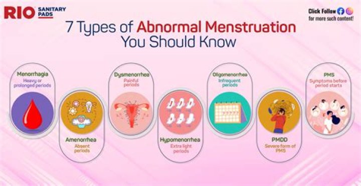 What should I do if I got my period stain at school?