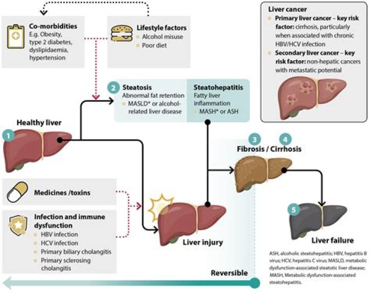 What vitamins can affect your liver?