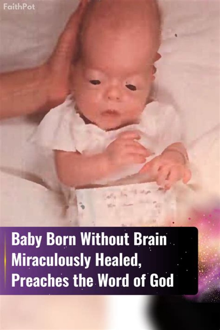 Whats it called when a baby is born without a brain?