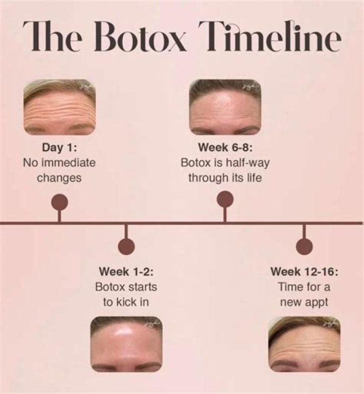 When Botox wears off where does it go?