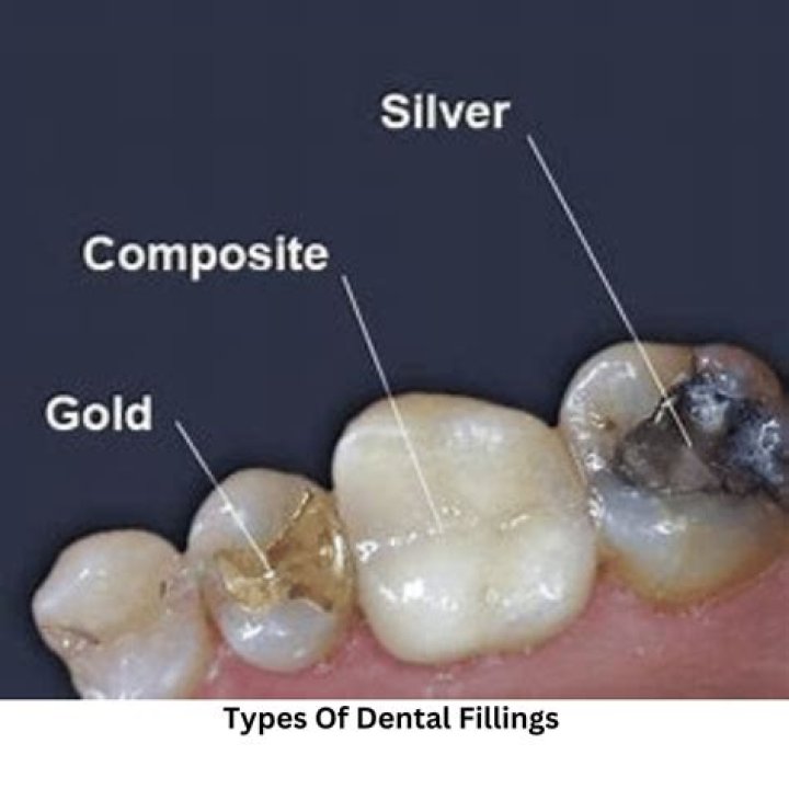 When did they stop using mercury fillings in teeth?