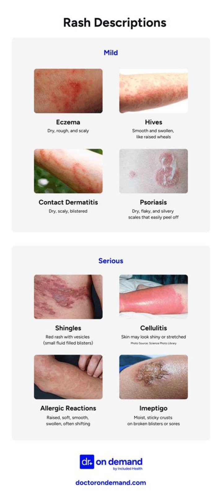 When is a rash serious?