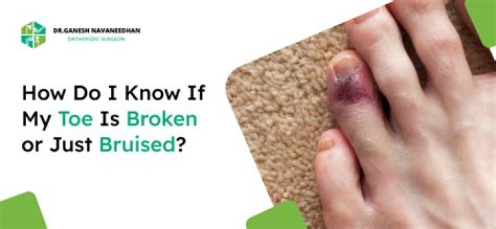 When will my broken toe feel better?