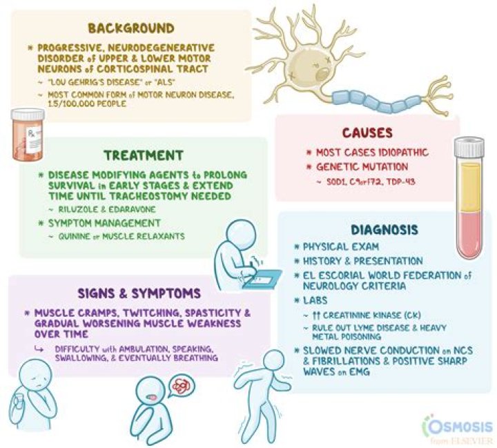 Where does ALS usually start?