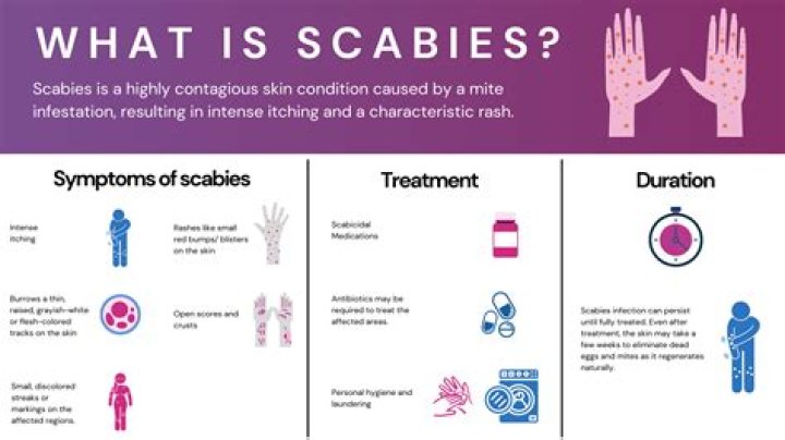 Where is scabies usually found on the body?