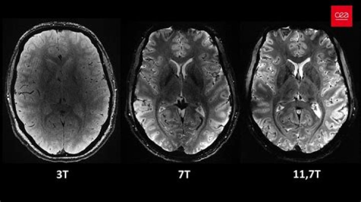 Who has a 7T MRI?