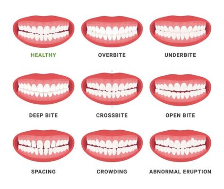 Why am I pushing my teeth with my tongue?