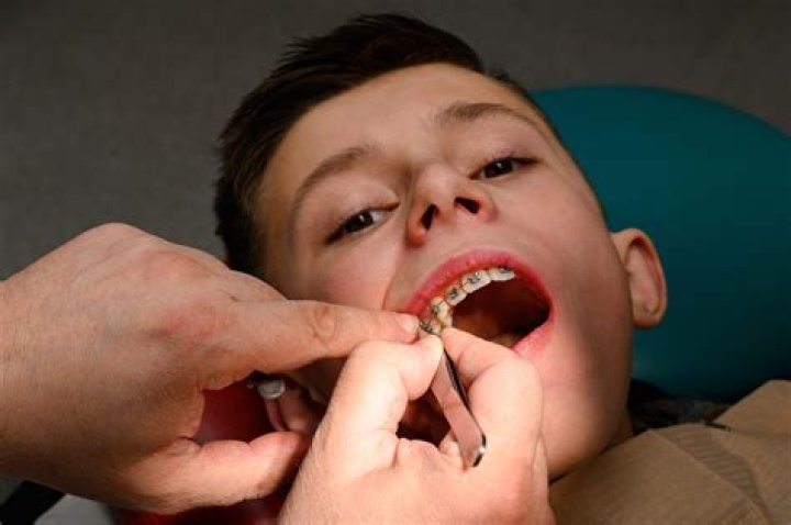 Why are my teeth taking so long to grow in?