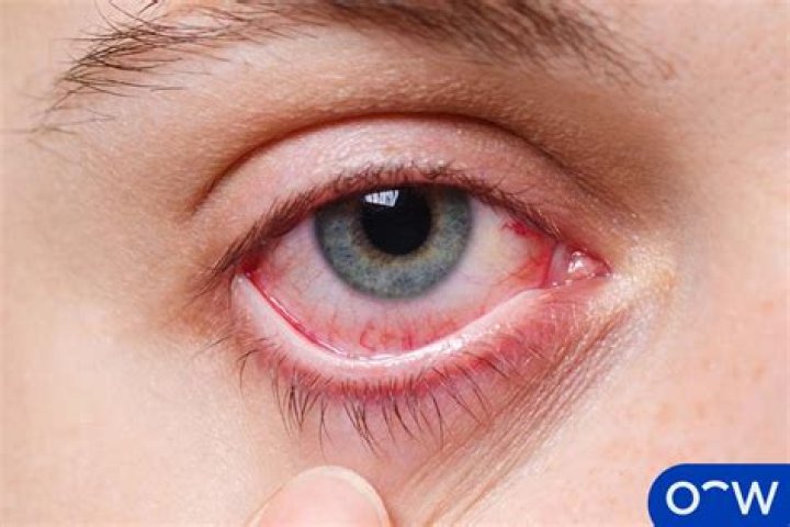 Why are Volturi eyes red?