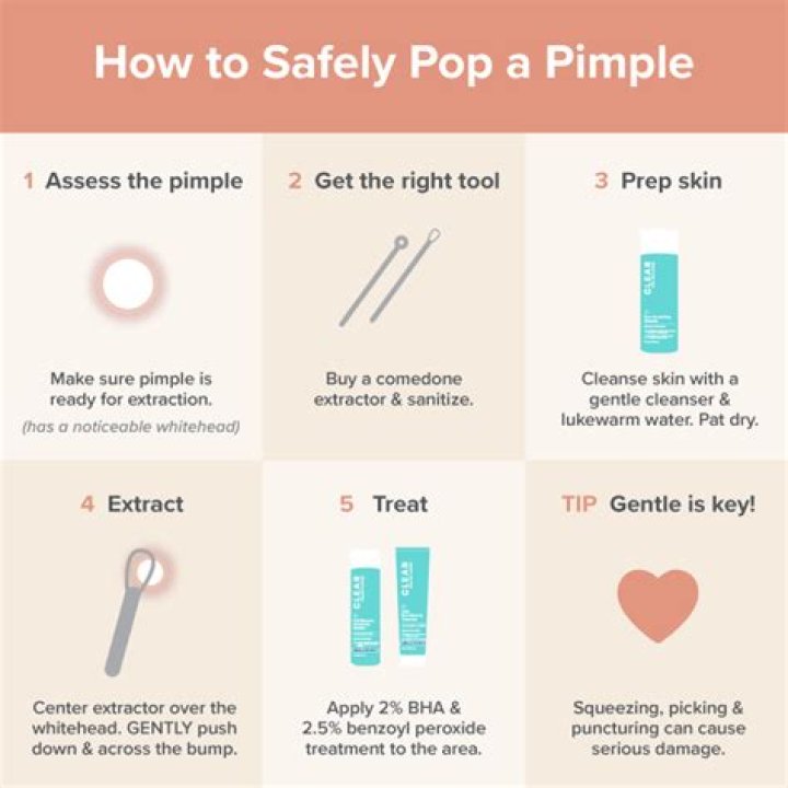 Why do dermatologists pop pimples?