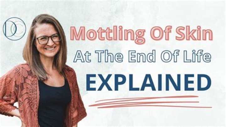 Why do elderly nod off?