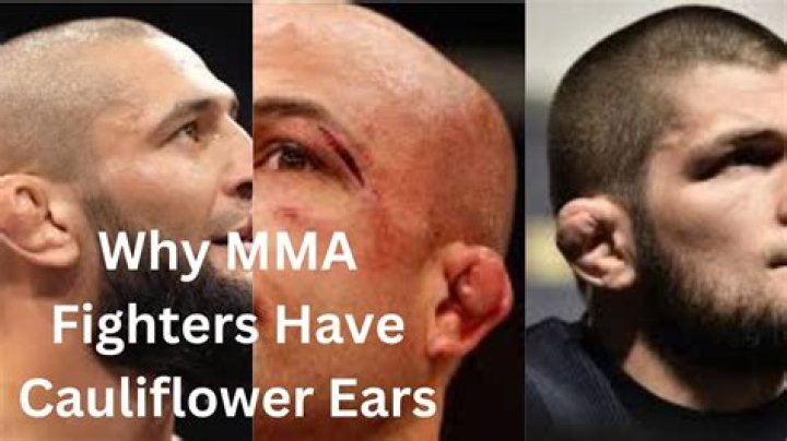 Why do fighters have weird ears?