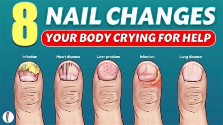 Why do fingernails grow after death?