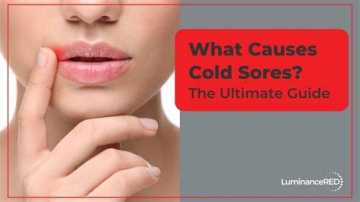 Why do I get cold sores from ChapStick?