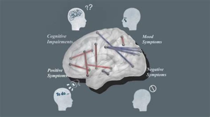 Why do I make up stories in my head?