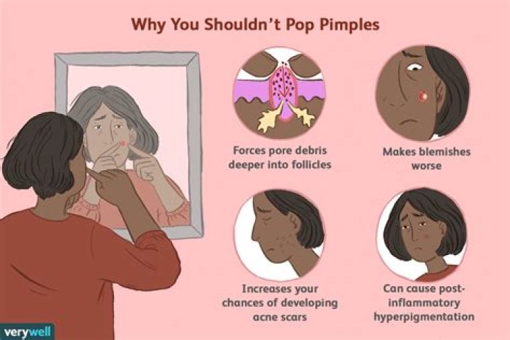 Why do some pimples stink when you pop them?