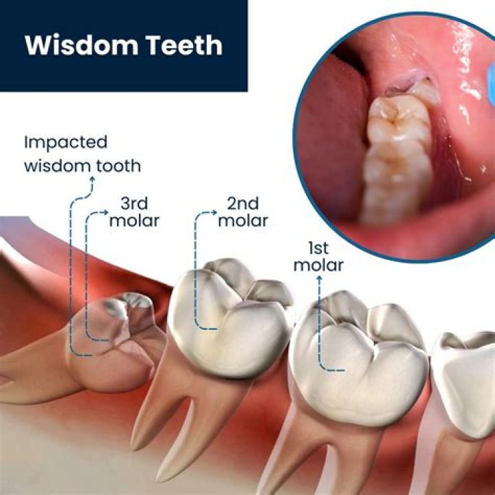 Why do teeth smell when drilling?