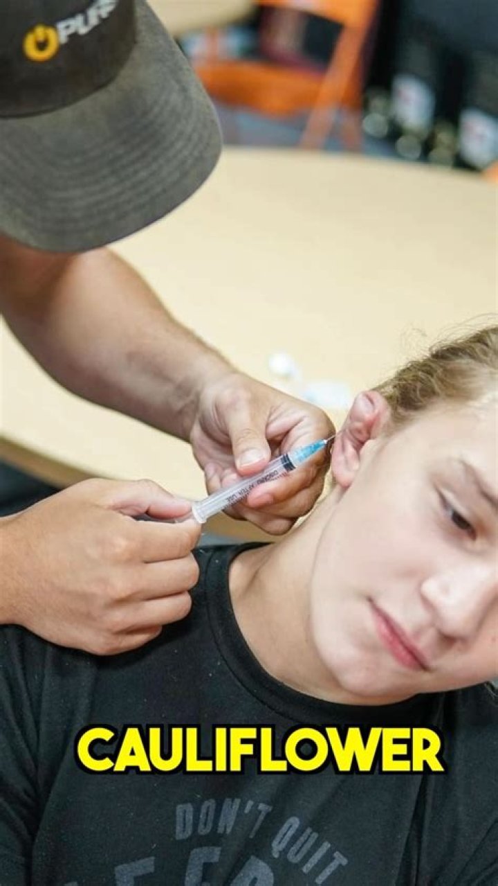 Why do wrestlers get cauliflower ears?