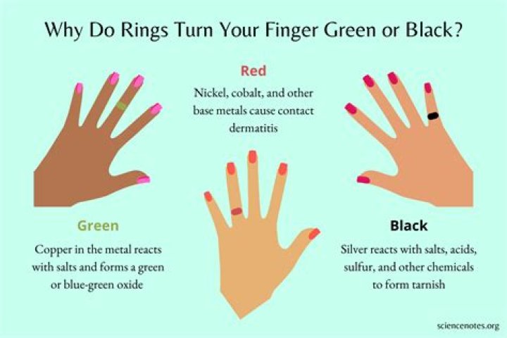Why does my 14 karat gold ring turn my finger black?