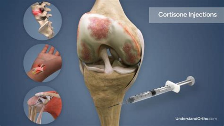 Why does my foot hurt worse after a cortisone shot?
