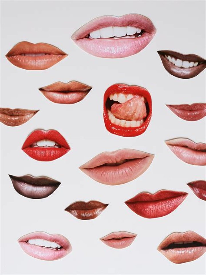 Why does my lip go up when I smile?