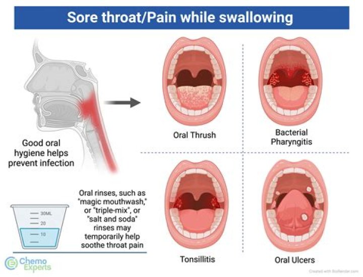 Why does my throat feel so clogged?