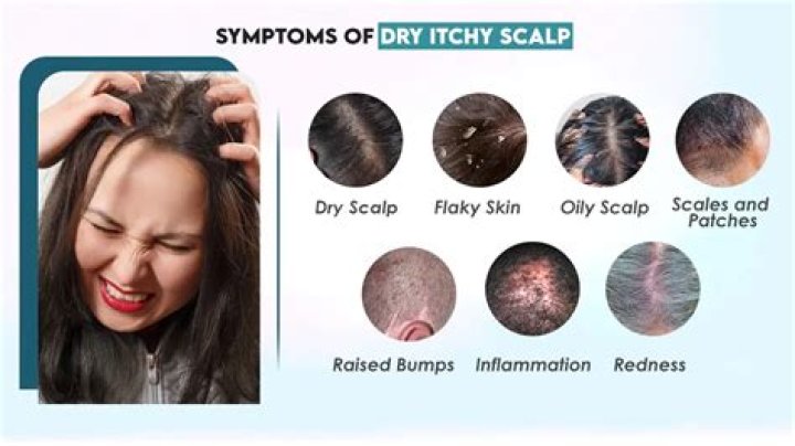 Why does scratching scalp feel good?