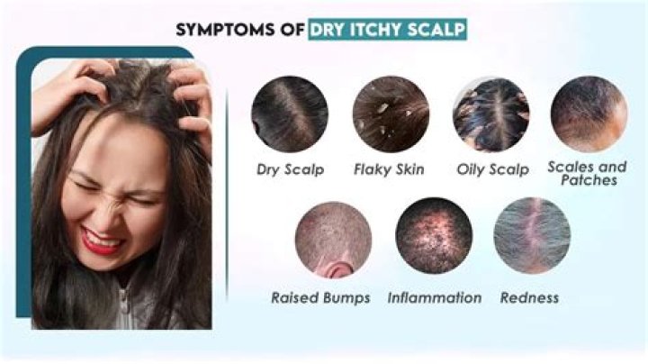 Why does your scalp itch when your hair is dirty?