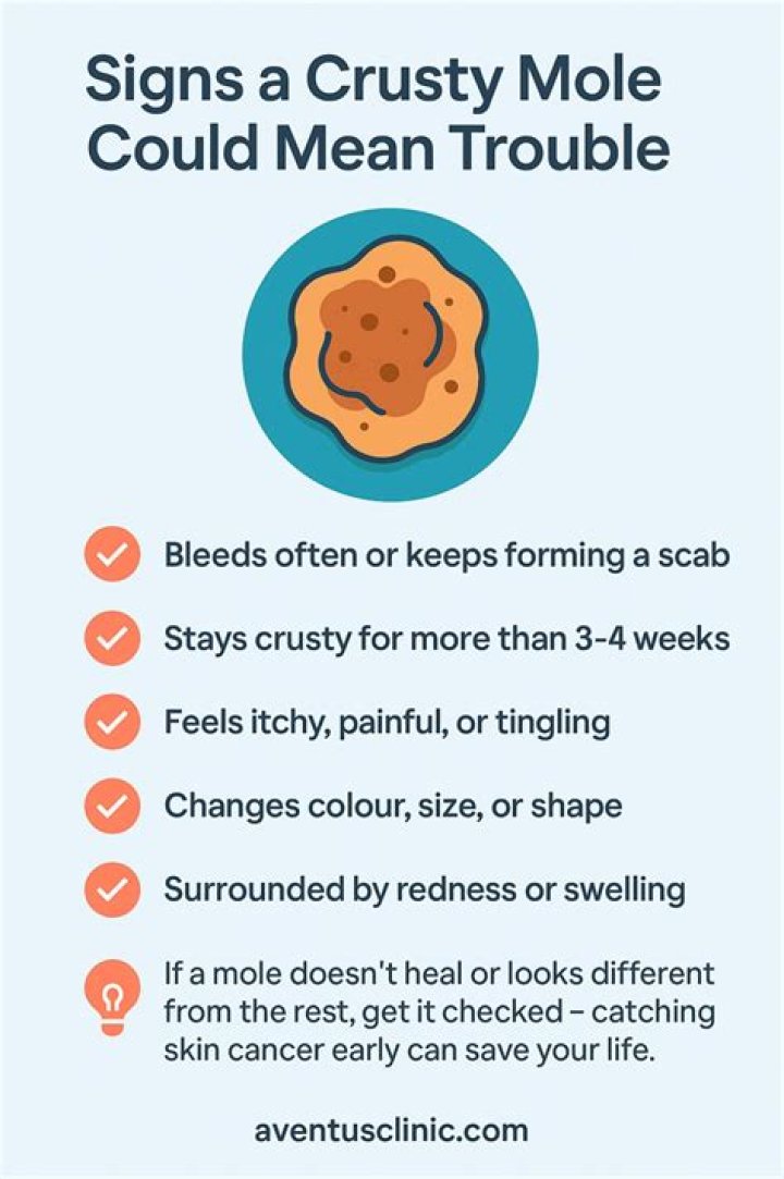 Why has my mole gone crusty?