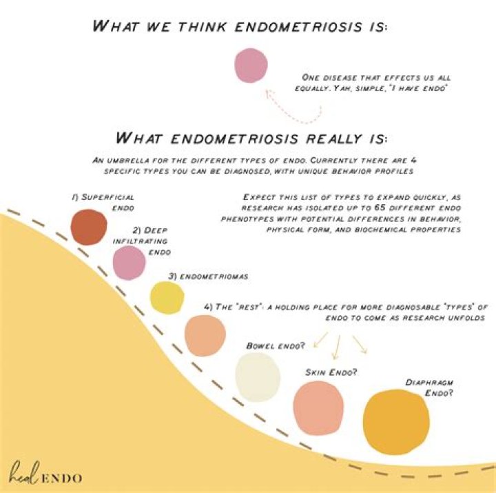 Why is endometriosis often misdiagnosed?
