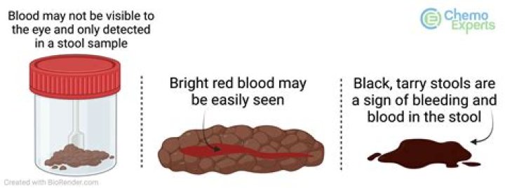 Why is my poop red but not blood?